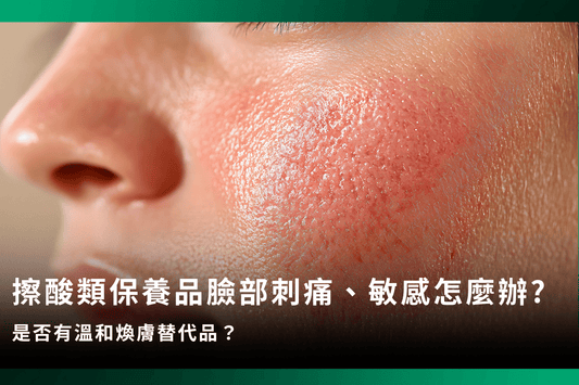 擦酸類保養品臉部刺痛、敏感該怎麼辦?是否有溫和煥膚替代品？