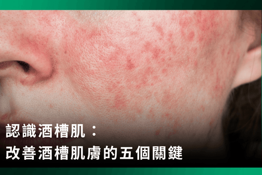 認識酒槽肌：改善酒槽肌膚的五個關鍵|科學證實有助於改善的七大成分